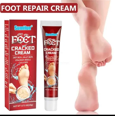  Cracked feet cream